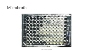 Microbroth
TONY SCARIA 2010 KMC
 