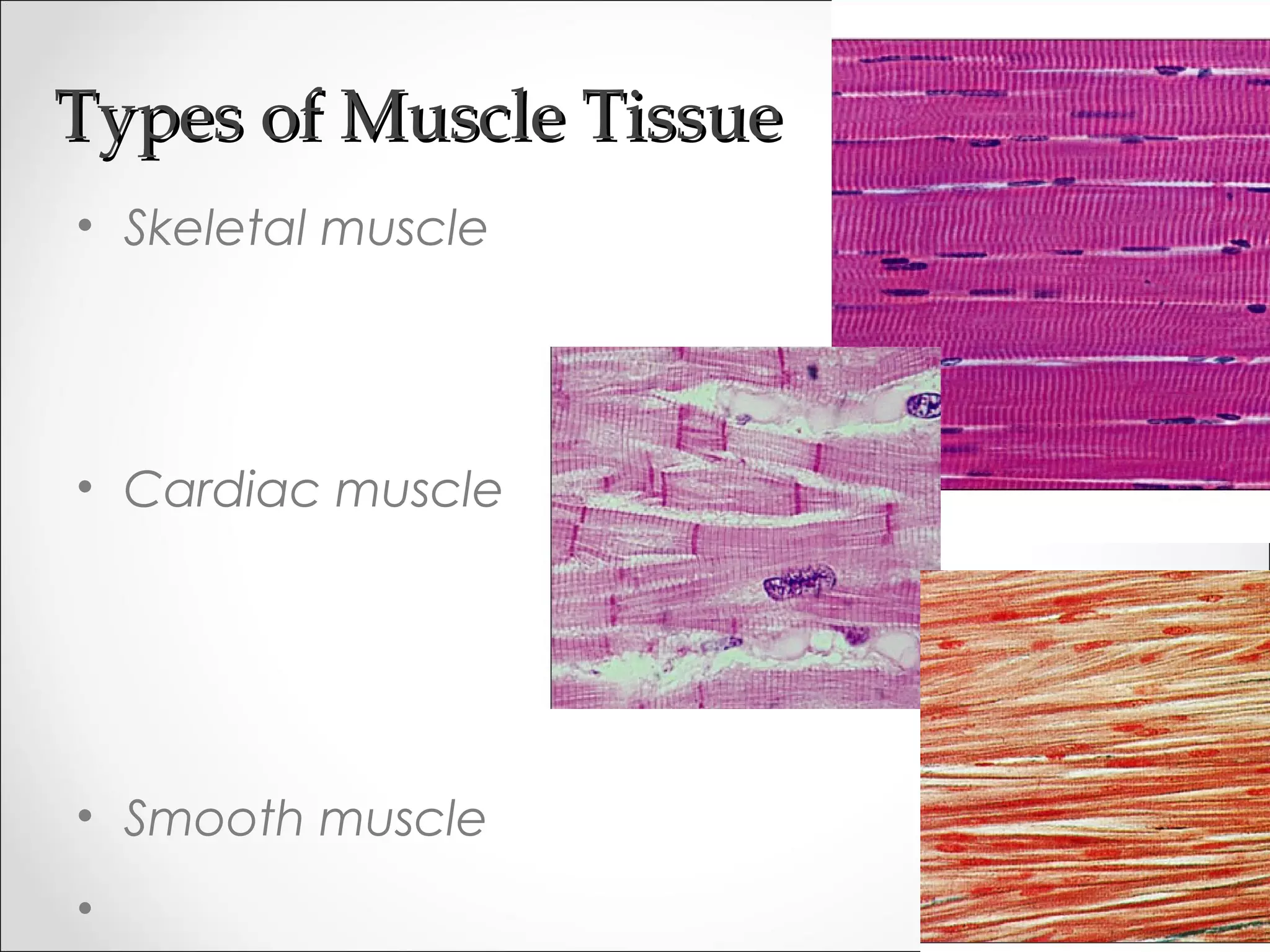 Types of Muscle TissueTypes of Muscle Tissue
• Skeletal muscle
• Cardiac muscle
• Smooth muscle
 