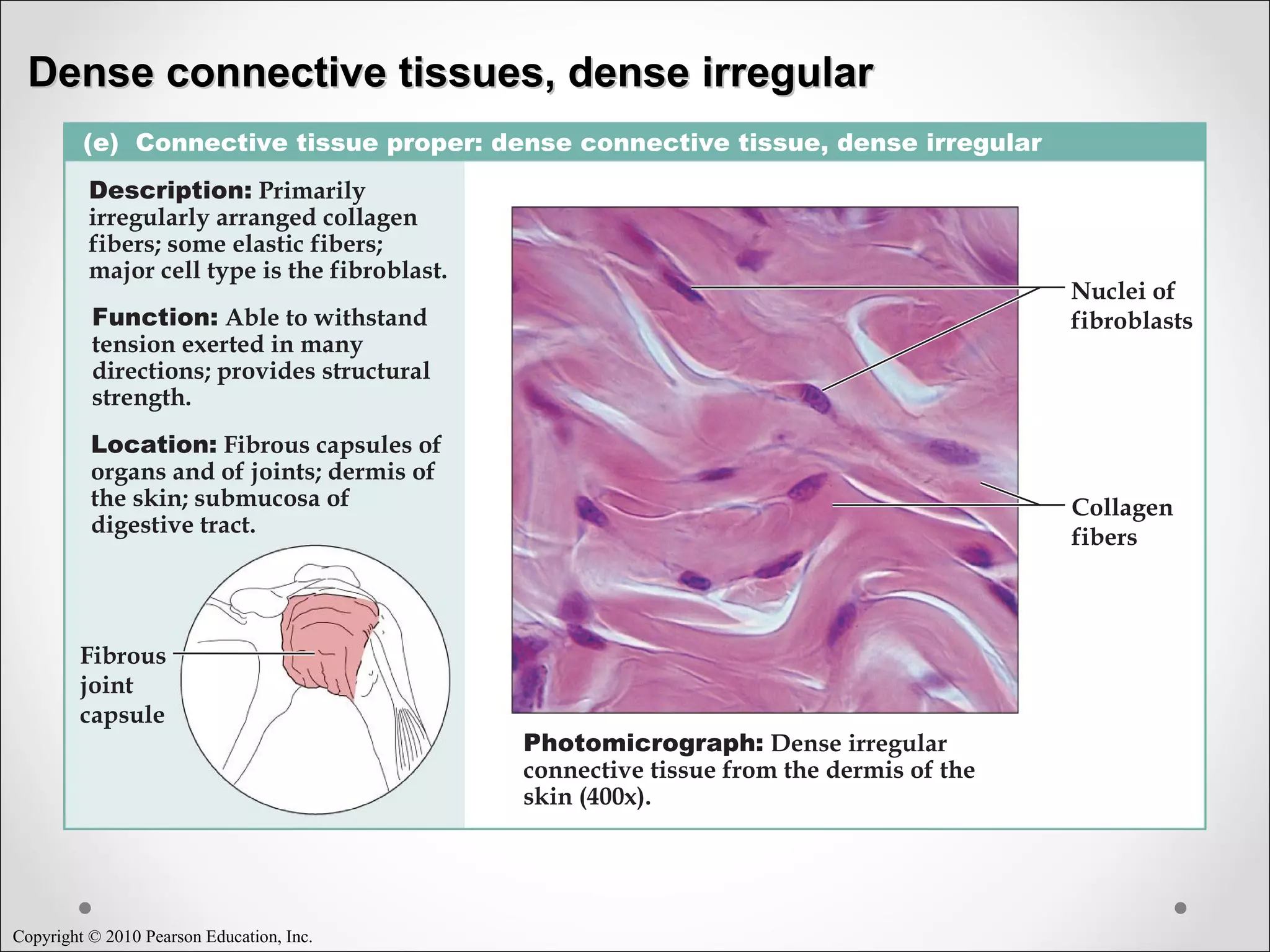 Copyright © 2010 Pearson Education, Inc.
(e) Connective tissue proper: dense connective tissue, dense irregular
Description: Primarily
irregularly arranged collagen
fibers; some elastic fibers;
major cell type is the fibroblast.
Function: Able to withstand
tension exerted in many
directions; provides structural
strength.
Location: Fibrous capsules of
organs and of joints; dermis of
the skin; submucosa of
digestive tract.
Photomicrograph: Dense irregular
connective tissue from the dermis of the
skin (400x).
Collagen
fibers
Nuclei of
fibroblasts
Fibrous
joint
capsule
Dense connective tissues, dense irregularDense connective tissues, dense irregular
 