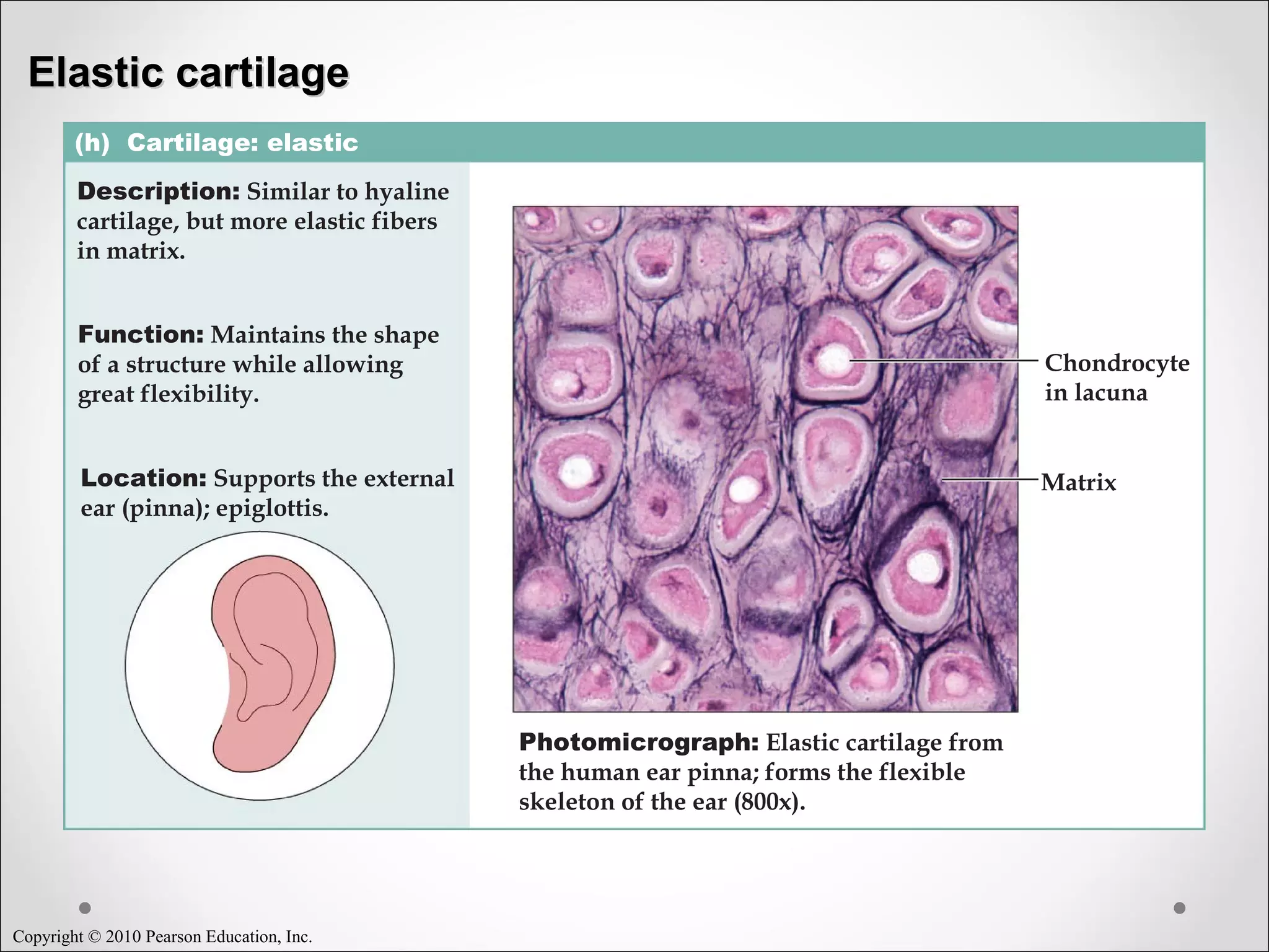 Copyright © 2010 Pearson Education, Inc.
(h) Cartilage: elastic
Description: Similar to hyaline
cartilage, but more elastic fibers
in matrix.
Function: Maintains the shape
of a structure while allowing
great flexibility.
Location: Supports the external
ear (pinna); epiglottis.
Photomicrograph: Elastic cartilage from
the human ear pinna; forms the flexible
skeleton of the ear (800x).
Chondrocyte
in lacuna
Matrix
Elastic cartilageElastic cartilage
 
