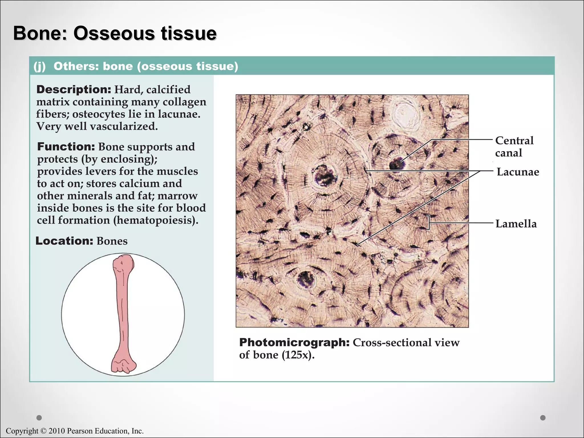Copyright © 2010 Pearson Education, Inc.
(j) Others: bone (osseous tissue)
Description: Hard, calcified
matrix containing many collagen
fibers; osteocytes lie in lacunae.
Very well vascularized.
Function: Bone supports and
protects (by enclosing);
provides levers for the muscles
to act on; stores calcium and
other minerals and fat; marrow
inside bones is the site for blood
cell formation (hematopoiesis).
Location: Bones
Photomicrograph: Cross-sectional view
of bone (125x).
Lacunae
Lamella
Central
canal
Bone: Osseous tissueBone: Osseous tissue
 