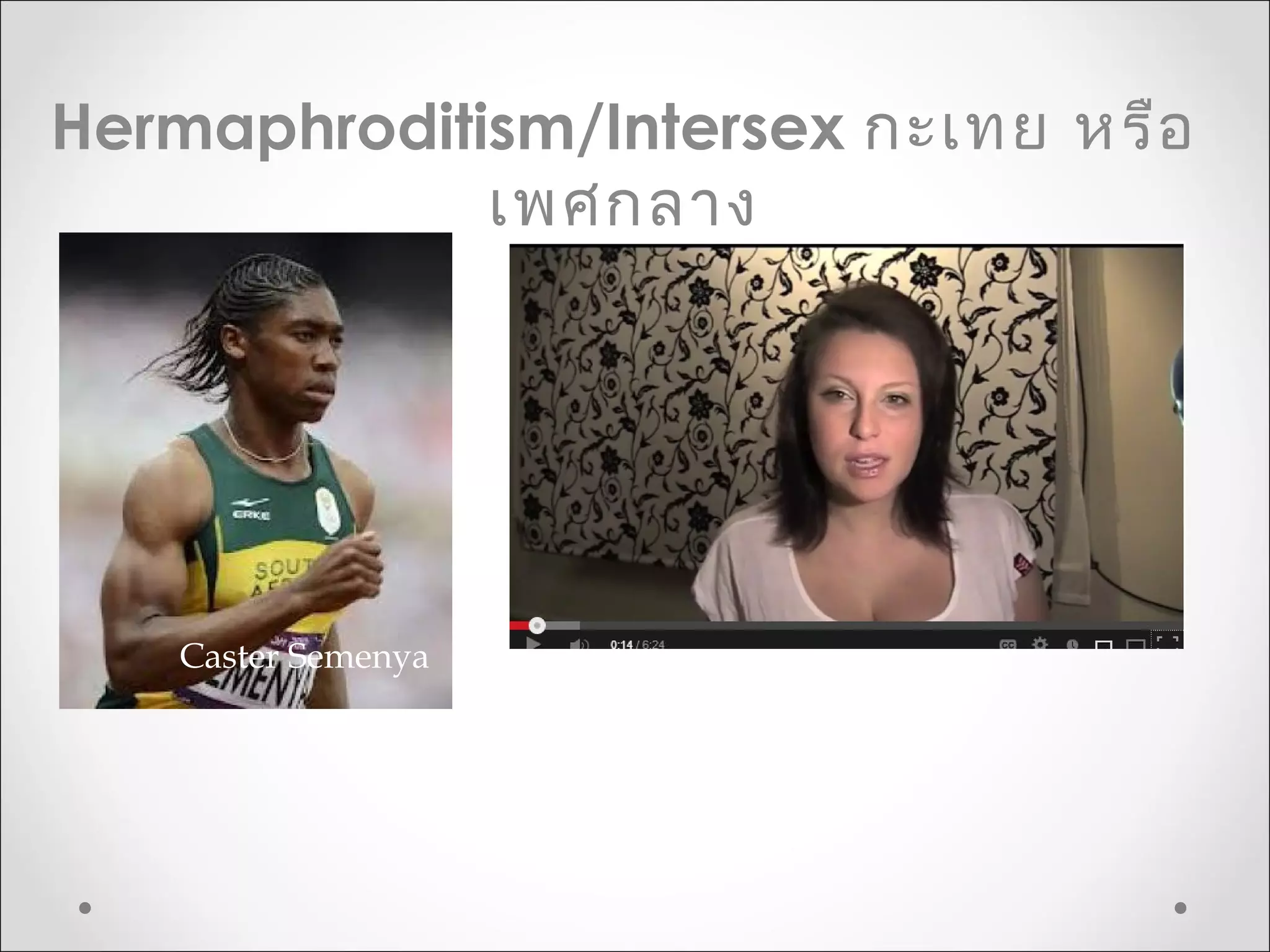Caster Semenya 
Hermaphroditism/Intersex กะเทย หรือ
เพศกลาง
 