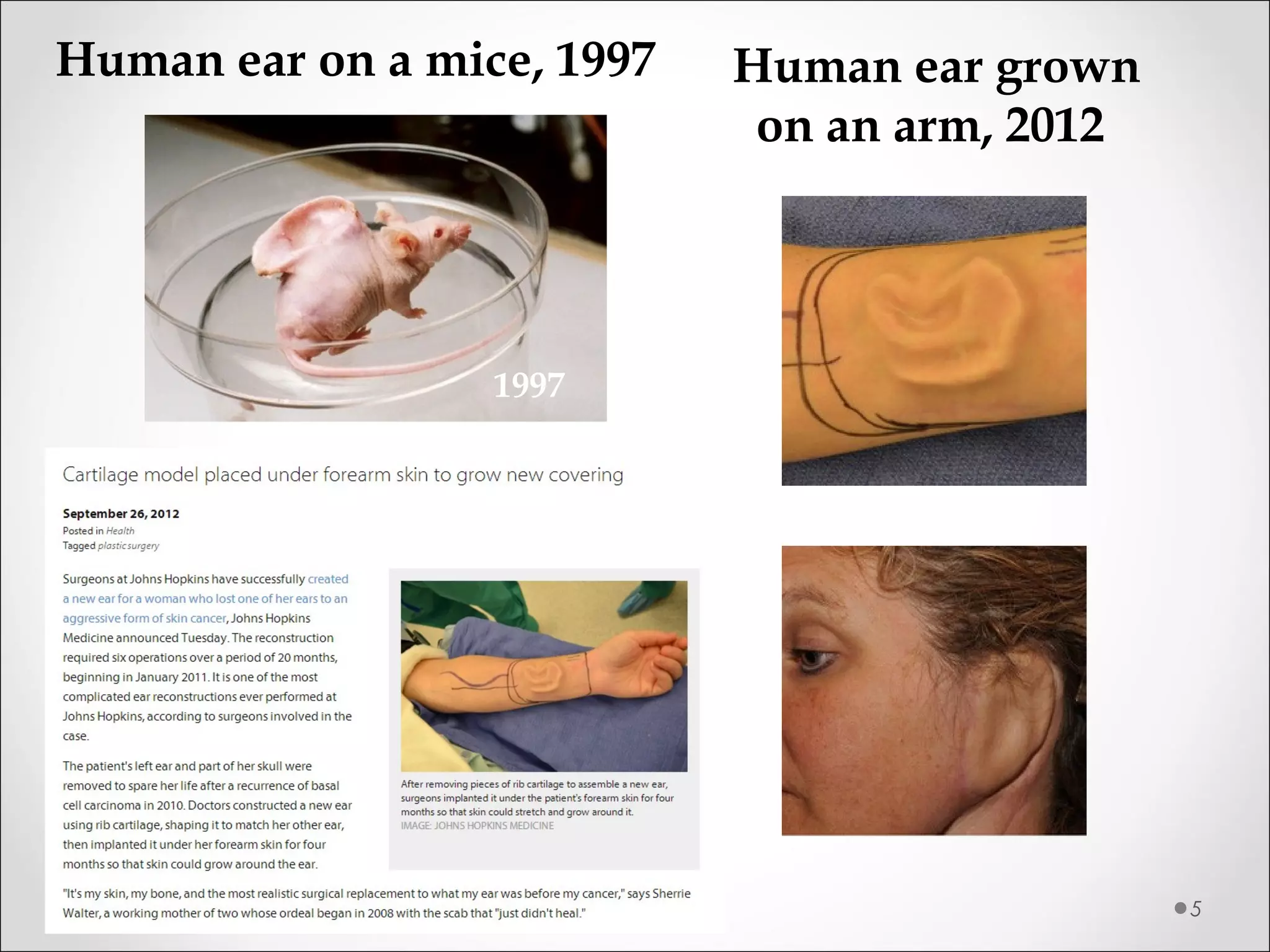 5
1997
Human ear on a mice, 1997 Human ear grown
on an arm, 2012
 