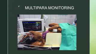 z
MULTIPARA MONITORING
 