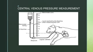 z
CENTRAL VENOUS PRESSURE MEASUREMENT
 
