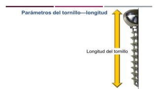 GENERALDADES TORNILLERIA 3.5.pptx