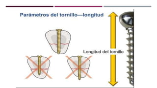 GENERALDADES TORNILLERIA 3.5.pptx