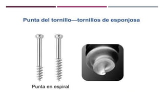 GENERALDADES TORNILLERIA 3.5.pptx