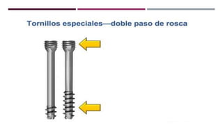 GENERALDADES TORNILLERIA 3.5.pptx