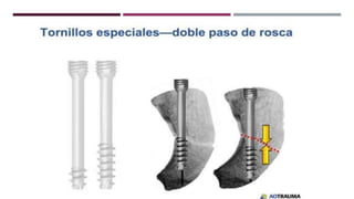 GENERALDADES TORNILLERIA 3.5.pptx