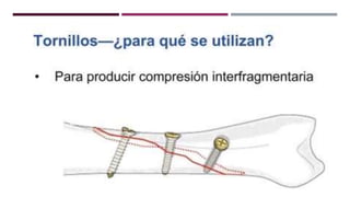 GENERALDADES TORNILLERIA 3.5.pptx