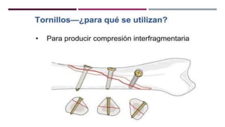 GENERALDADES TORNILLERIA 3.5.pptx