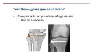 GENERALDADES TORNILLERIA 3.5.pptx