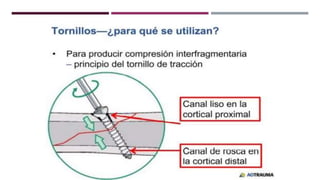 GENERALDADES TORNILLERIA 3.5.pptx