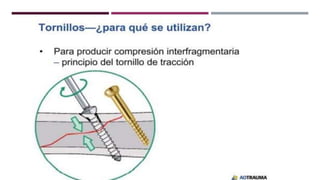 GENERALDADES TORNILLERIA 3.5.pptx