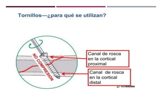 GENERALDADES TORNILLERIA 3.5.pptx