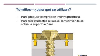 GENERALDADES TORNILLERIA 3.5.pptx