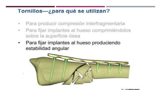 GENERALDADES TORNILLERIA 3.5.pptx