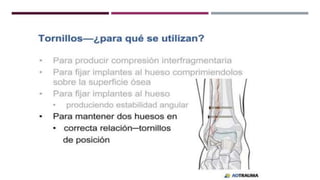 GENERALDADES TORNILLERIA 3.5.pptx