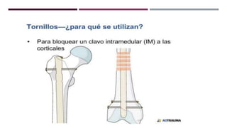 GENERALDADES TORNILLERIA 3.5.pptx