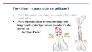 GENERALDADES TORNILLERIA 3.5.pptx