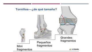 GENERALDADES TORNILLERIA 3.5.pptx