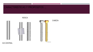 EJE CENTRAL
ROSCA
CABEZA
CARACTERISTICAS Y PROPOSITOS …
 