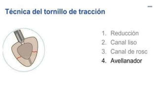 GENERALDADES TORNILLERIA 3.5.pptx