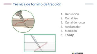 GENERALDADES TORNILLERIA 3.5.pptx