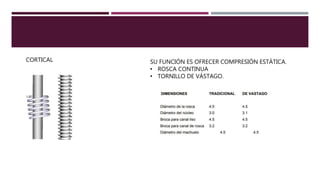 CORTICAL SU FUNCIÓN ES OFRECER COMPRESIÓN ESTÁTICA.
• ROSCA CONTINUA
• TORNILLO DE VÁSTAGO.
 