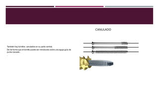 CANULADO
También hay tornillos canulados en su parte central.
De tal forma que el tornillo puede ser introducido sobre una aguja guía de
punta roscada .
.
 