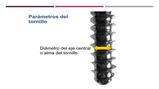 GENERALDADES TORNILLERIA 3.5.pptx