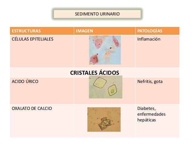 General de orina doniz