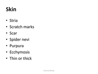 Skin
• Stria
• Scratch marks
• Scar
• Spider nevi
• Purpura
• Ecchymosis
• Thin or thick
Shaimaa Elkholy
 