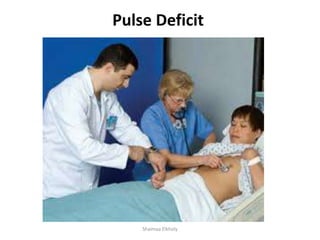 Pulse Deficit Method General examination | PPTX