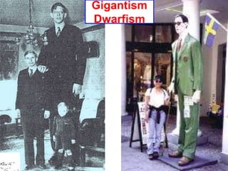 Gigantism
Dwarfism
 