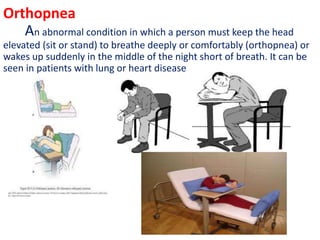 Orthopnea
An abnormal condition in which a person must keep the head
elevated (sit or stand) to breathe deeply or comfortably (orthopnea) or
wakes up suddenly in the middle of the night short of breath. It can be
seen in patients with lung or heart disease
 
