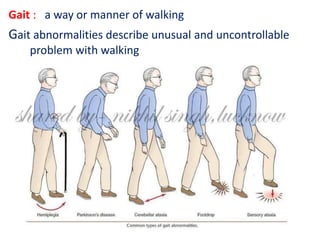 Gait : a way or manner of walking
Gait abnormalities describe unusual and uncontrollable
problem with walking
 