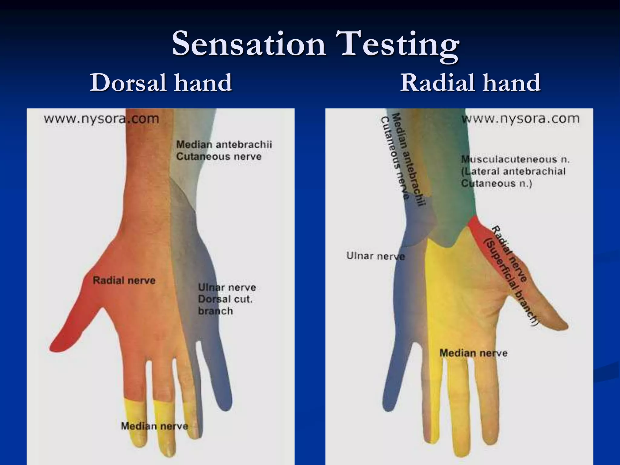 Sensation Testing
Dorsal hand Radial hand
 
