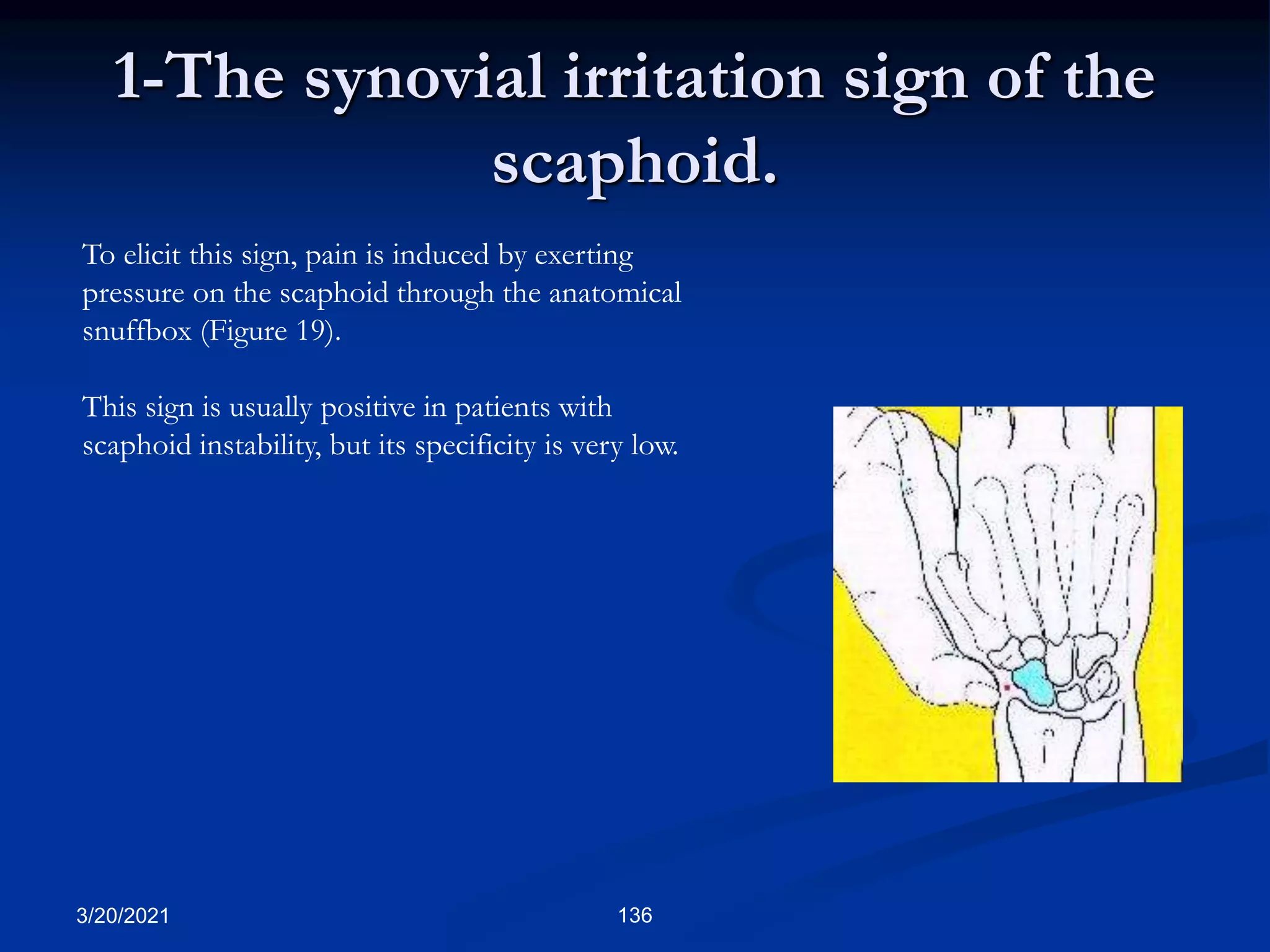 1-The synovial irritation sign of the
scaphoid.
To elicit this sign, pain is induced by exerting
pressure on the scaphoid through the anatomical
snuffbox (Figure 19).
This sign is usually positive in patients with
scaphoid instability, but its specificity is very low.
3/20/2021 136
 