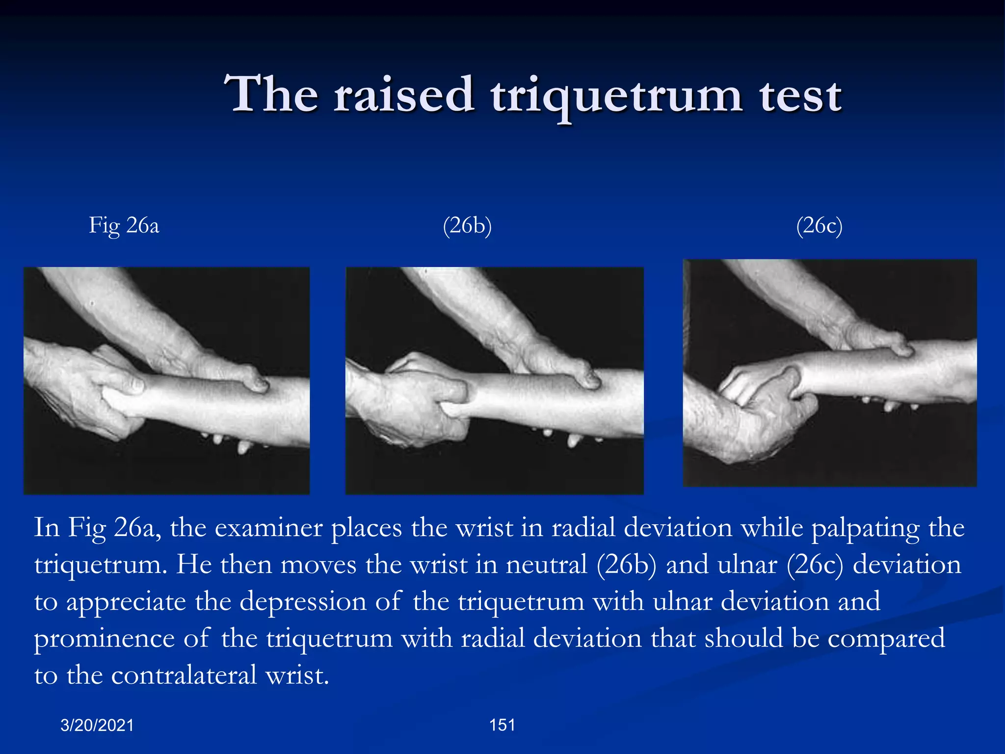 The raised triquetrum test
In Fig 26a, the examiner places the wrist in radial deviation while palpating the
triquetrum. He then moves the wrist in neutral (26b) and ulnar (26c) deviation
to appreciate the depression of the triquetrum with ulnar deviation and
prominence of the triquetrum with radial deviation that should be compared
to the contralateral wrist.
Fig 26a (26b) (26c)
3/20/2021 151
 