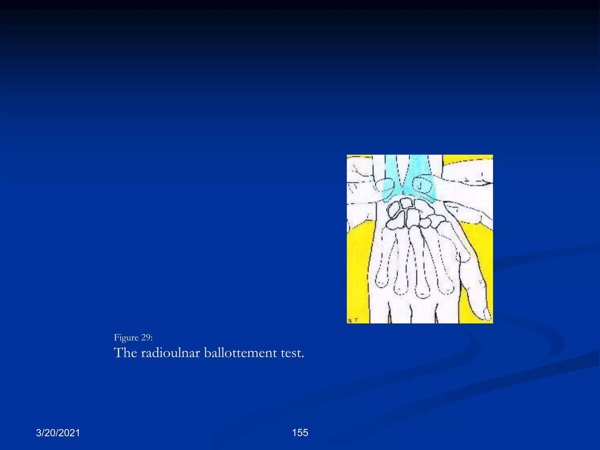 3/20/2021 155
Figure 29:
The radioulnar ballottement test.
 