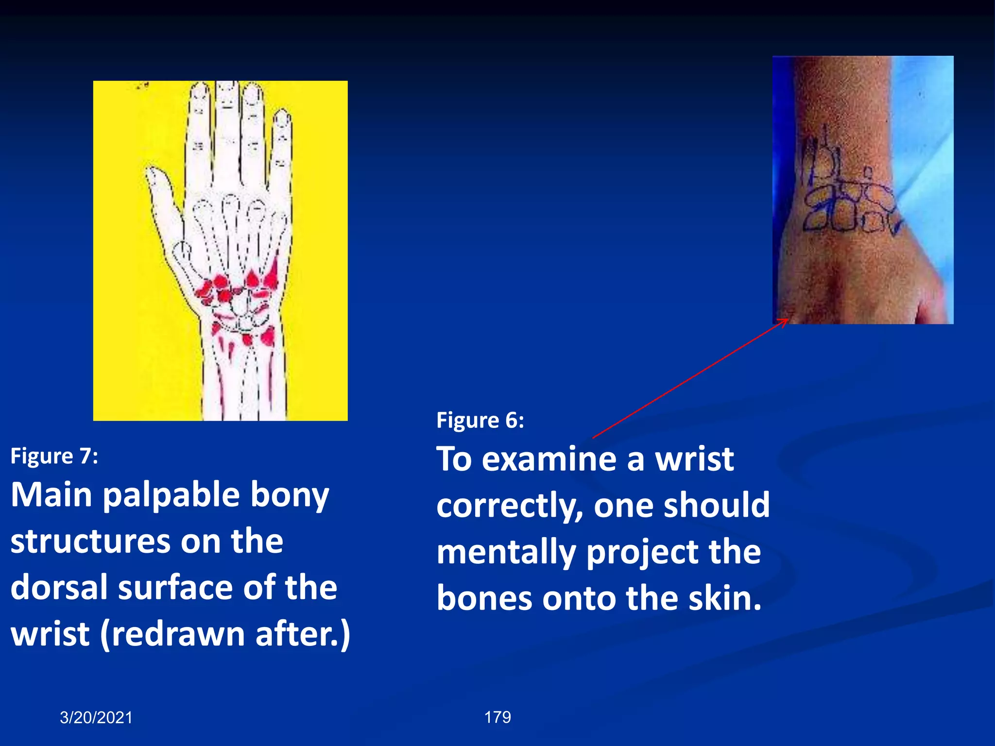 Figure 6:
To examine a wrist
correctly, one should
mentally project the
bones onto the skin.
Figure 7:
Main palpable bony
structures on the
dorsal surface of the
wrist (redrawn after.)
3/20/2021 179
 