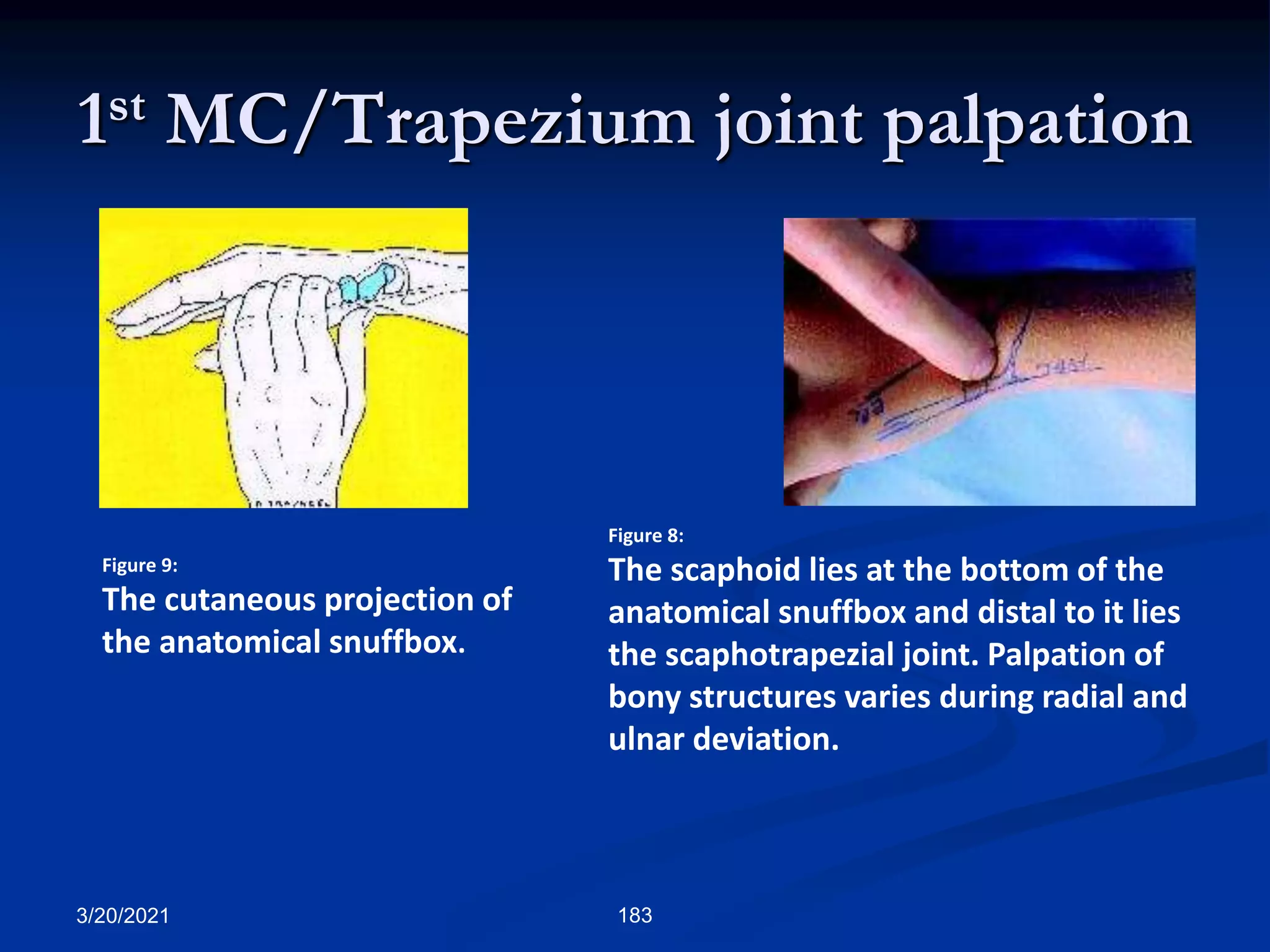 1st MC/Trapezium joint palpation
3/20/2021 183
Figure 9:
The cutaneous projection of
the anatomical snuffbox.
Figure 8:
The scaphoid lies at the bottom of the
anatomical snuffbox and distal to it lies
the scaphotrapezial joint. Palpation of
bony structures varies during radial and
ulnar deviation.
 