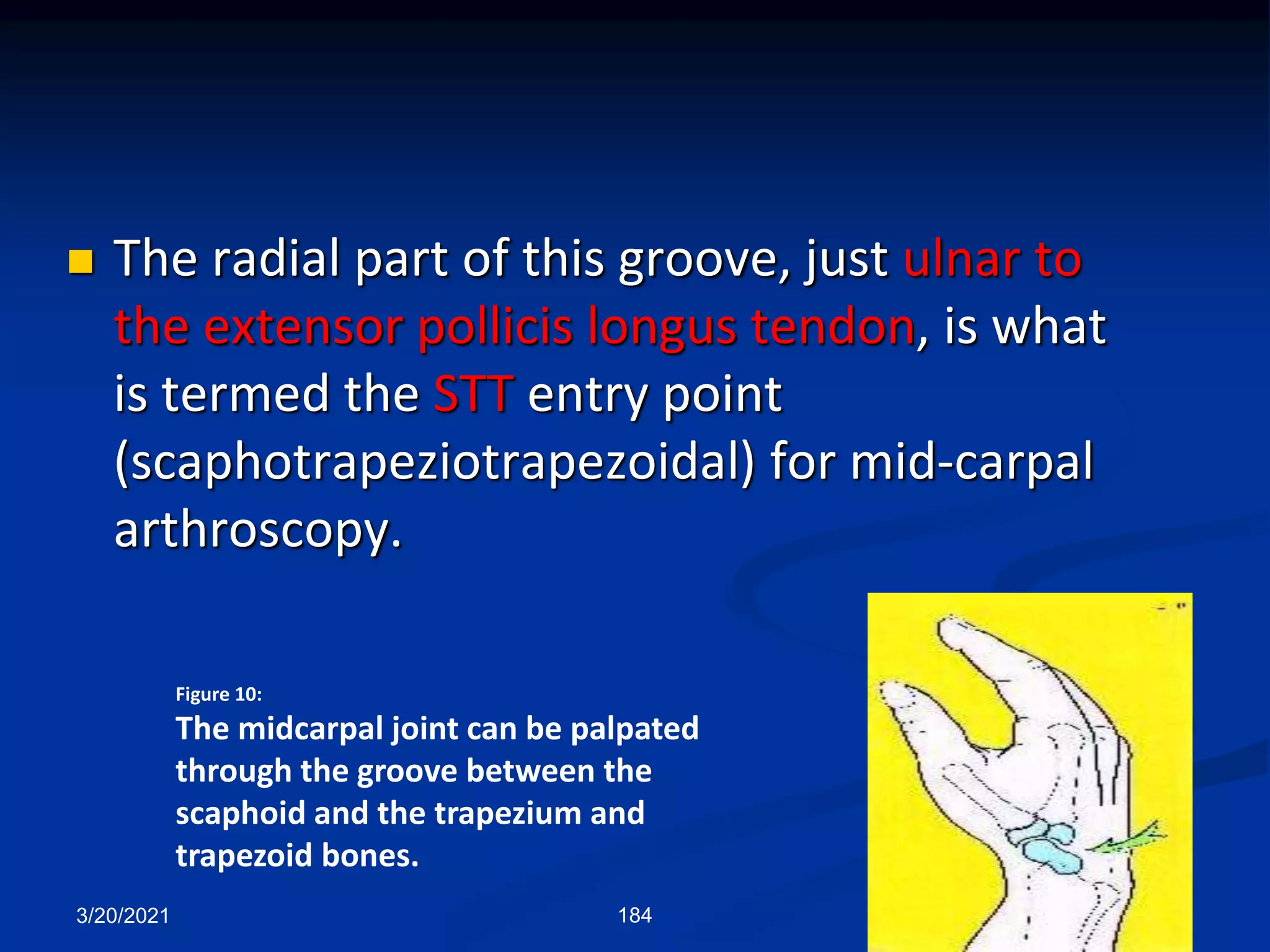 3/20/2021 184
 The radial part of this groove, just ulnar to
the extensor pollicis longus tendon, is what
is termed the STT entry point
(scaphotrapeziotrapezoidal) for mid-carpal
arthroscopy.
Figure 10:
The midcarpal joint can be palpated
through the groove between the
scaphoid and the trapezium and
trapezoid bones.
 