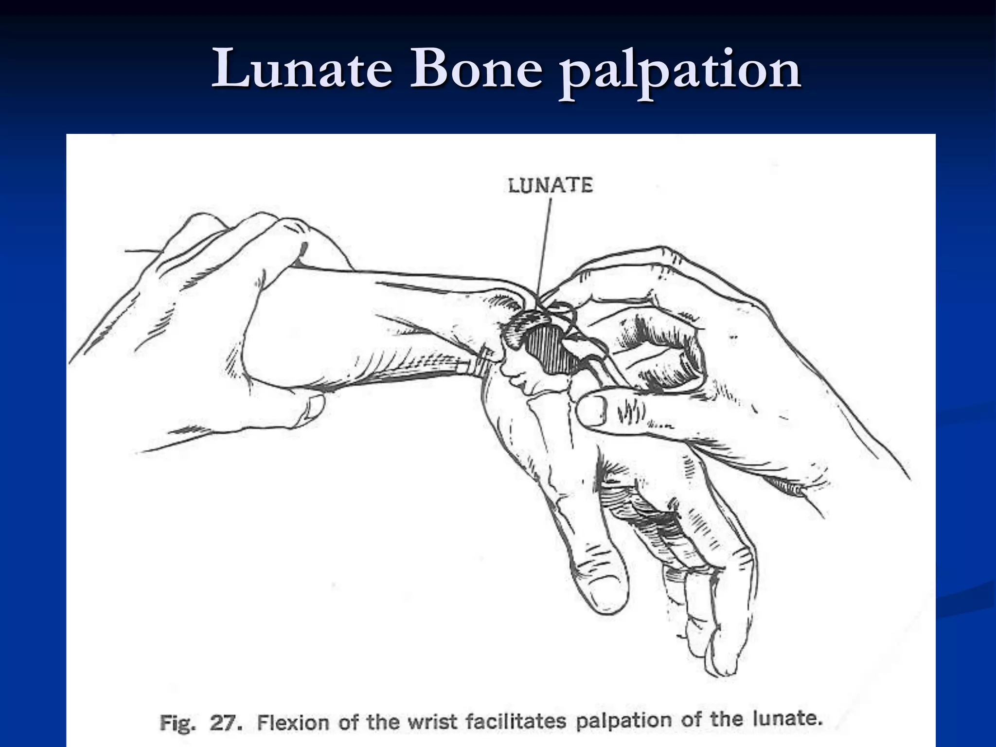 Lunate Bone palpation
IUMS
 