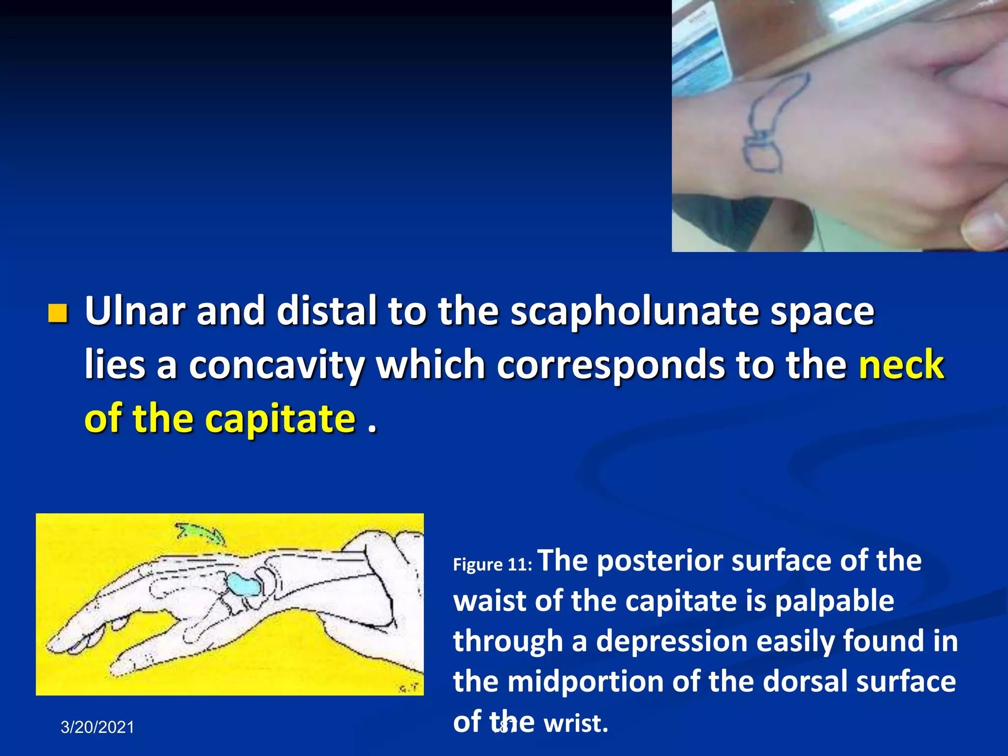 3/20/2021 187
 Ulnar and distal to the scapholunate space
lies a concavity which corresponds to the neck
of the capitate .
Figure 11: The posterior surface of the
waist of the capitate is palpable
through a depression easily found in
the midportion of the dorsal surface
of the wrist.
 
