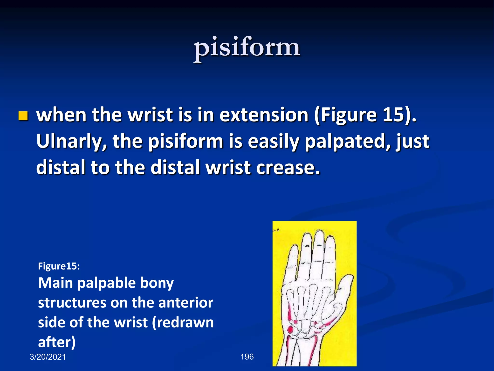 pisiform
3/20/2021 196
 when the wrist is in extension (Figure 15).
Ulnarly, the pisiform is easily palpated, just
distal to the distal wrist crease.
Figure15:
Main palpable bony
structures on the anterior
side of the wrist (redrawn
after)
 
