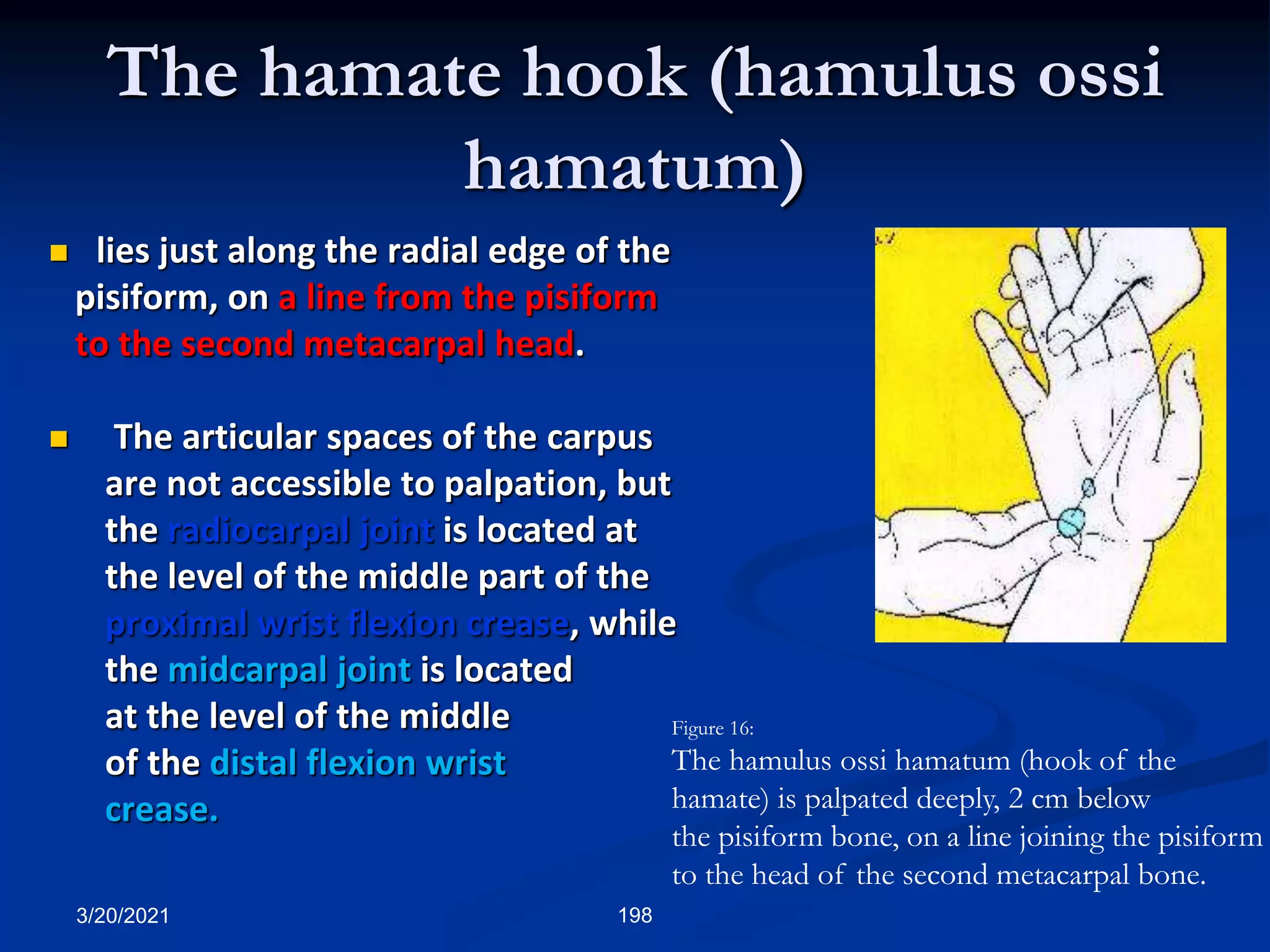 The hamate hook (hamulus ossi
hamatum)
Figure 16:
The hamulus ossi hamatum (hook of the
hamate) is palpated deeply, 2 cm below
the pisiform bone, on a line joining the pisiform
to the head of the second metacarpal bone.
3/20/2021 198
 lies just along the radial edge of the
pisiform, on a line from the pisiform
to the second metacarpal head.
 The articular spaces of the carpus
are not accessible to palpation, but
the radiocarpal joint is located at
the level of the middle part of the
proximal wrist flexion crease, while
the midcarpal joint is located
at the level of the middle
of the distal flexion wrist
crease.
 