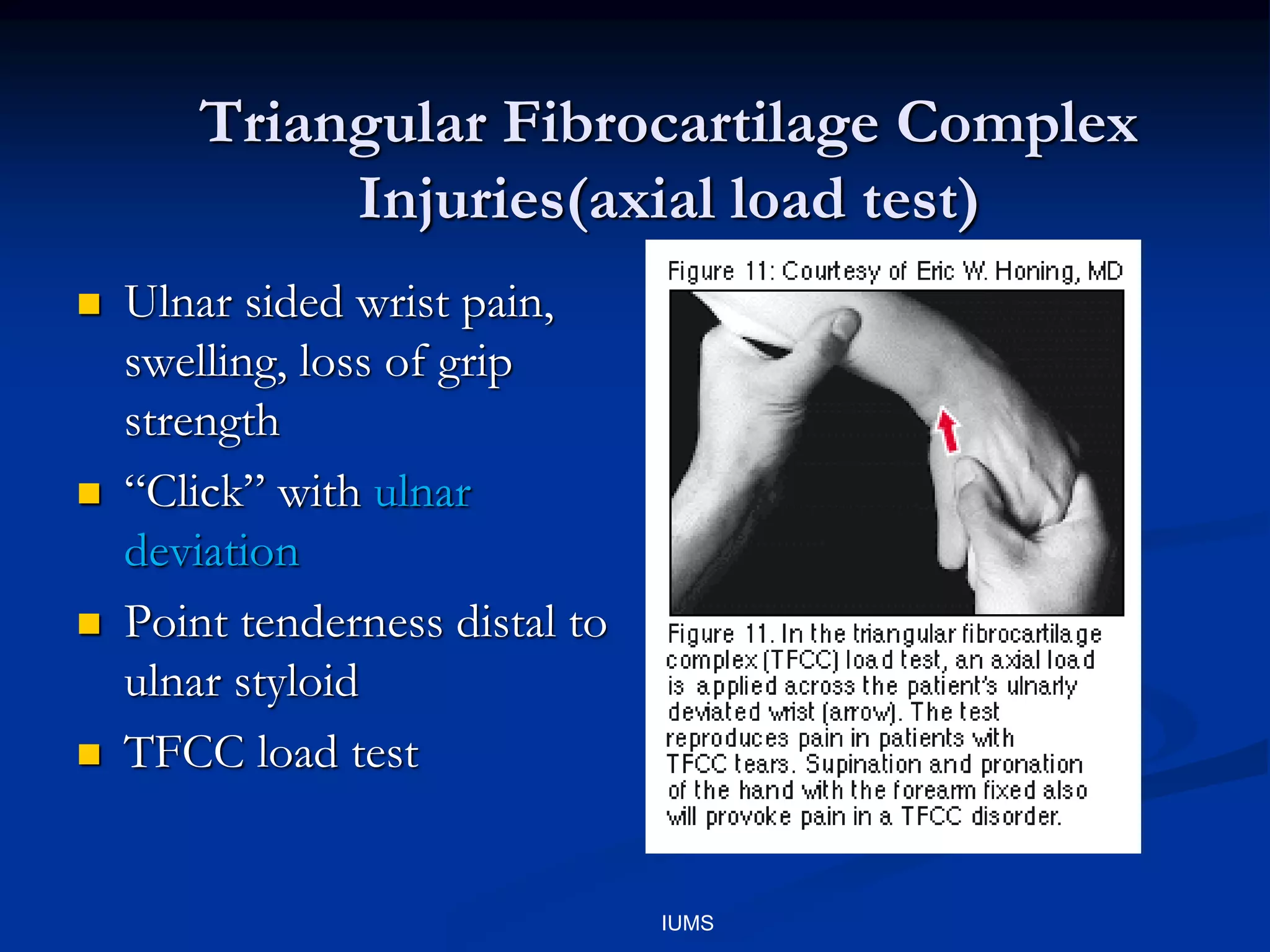 Triangular Fibrocartilage Complex
Injuries(axial load test)
 Ulnar sided wrist pain,
swelling, loss of grip
strength
 “Click” with ulnar
deviation
 Point tenderness distal to
ulnar styloid
 TFCC load test
IUMS
 
